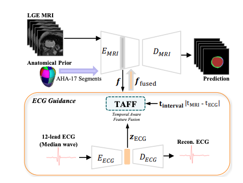 ECG MRI