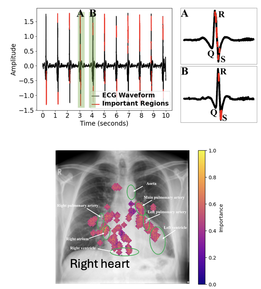 Low-cost Cardiac Hemodynamics Thumbnail